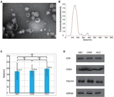 The Potential of Serum Exosomal hsa_circ_0028861 as the Novel Diagnostic Biomarker of HBV-Derived Hepatocellular Cancer